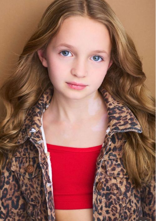 cast-image
